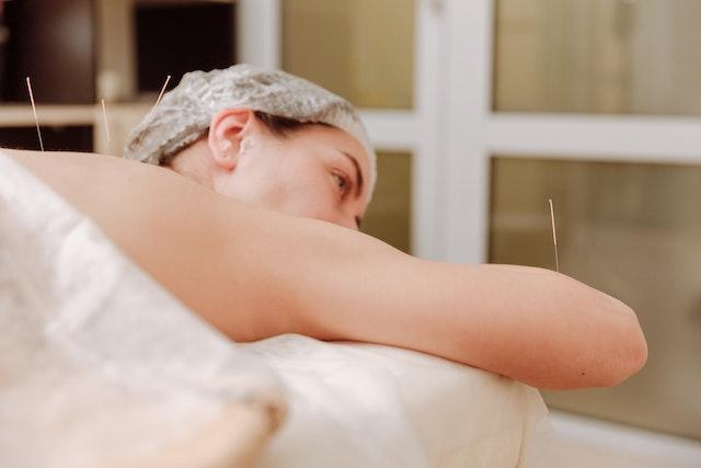 a woman laying on a bed with a towel around her neck and receiving acupuncture treatment